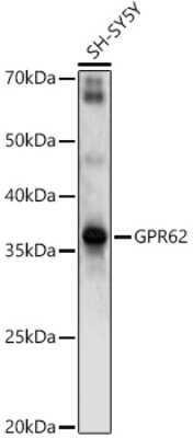 Western Blot: GPR62 AntibodyAzide and BSA Free [NBP3-03927]